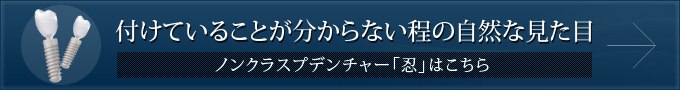 付けていることが分からない程の自然な見た目 ノンクラスプデンチャー「忍」はこちら
